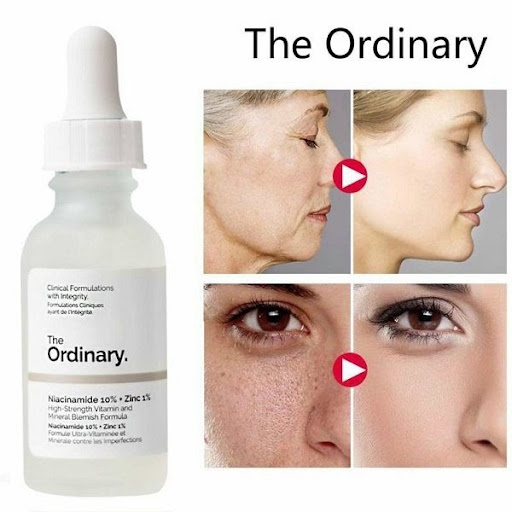 Sử dụng The Ordinary mỗi ngày giúp sạch mụn, trẻ hóa làn da