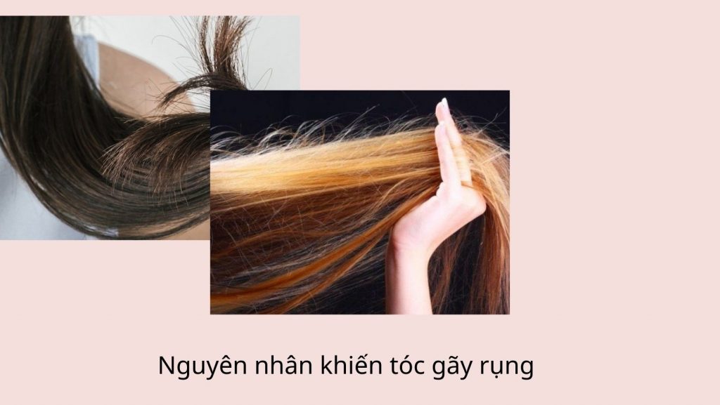 Nguyên nhân khiến tóc gãy rụng