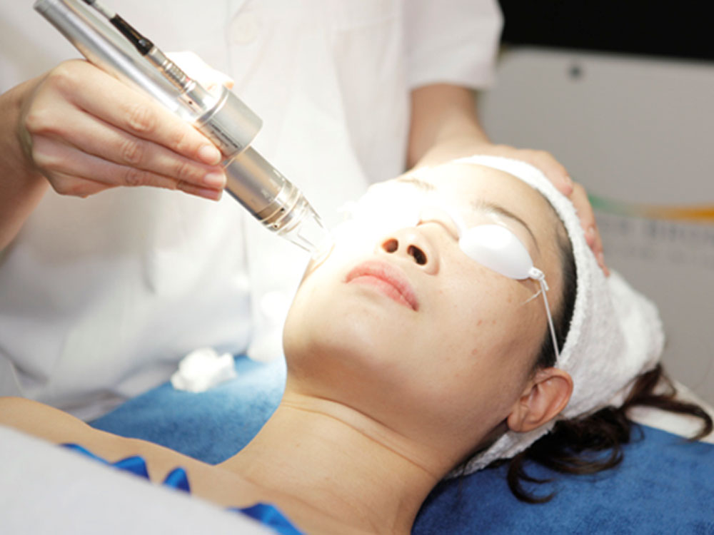 Phương pháp điều trị bằng laser - điều trị các vết sẹo rỗ