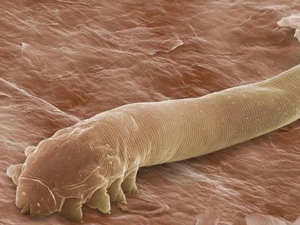 Demodex