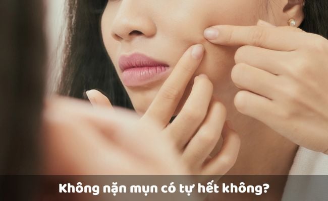 Không năn mụn có tự hết?