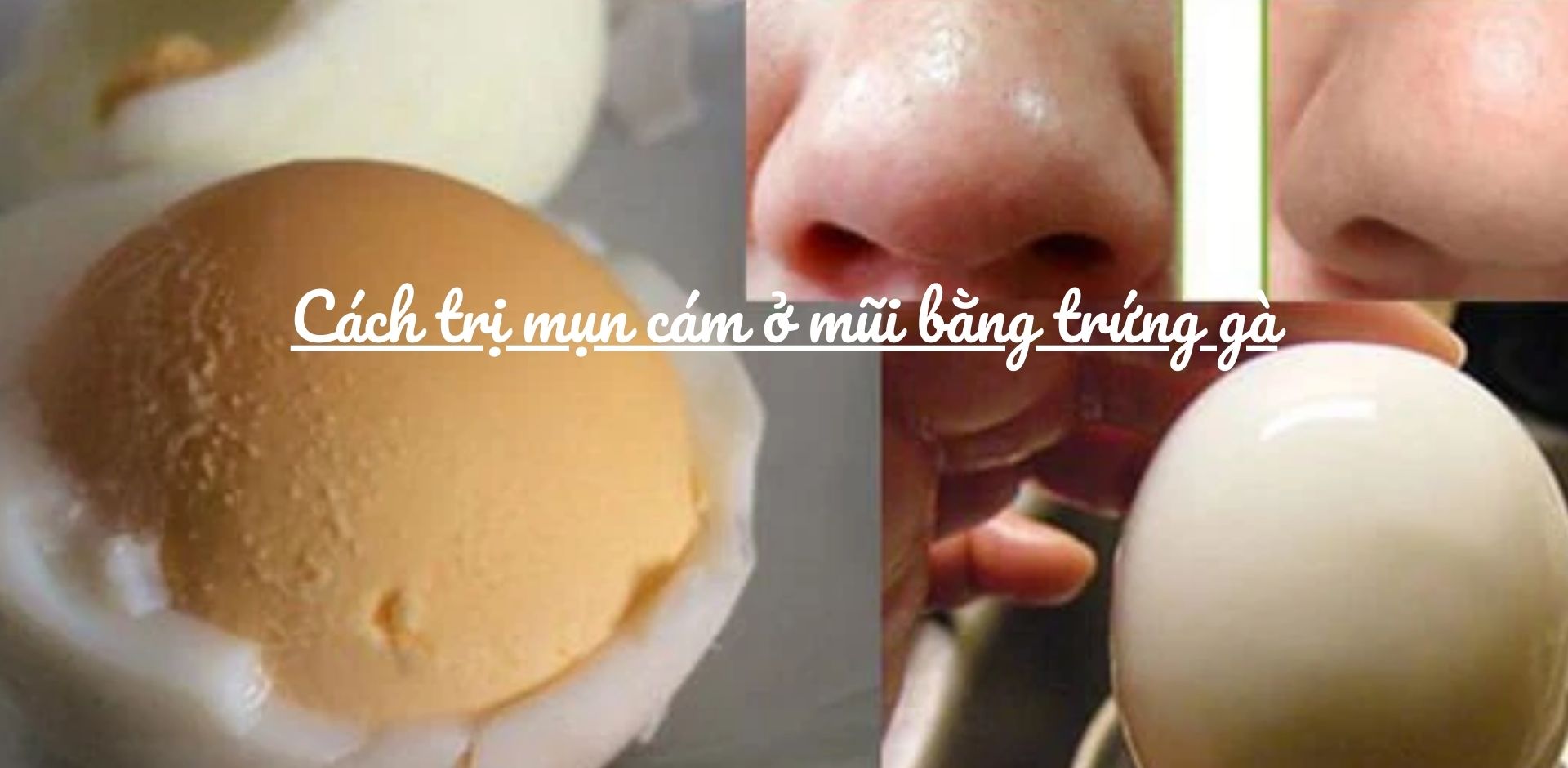 Hướng dẫn cách trị mụn cám ở mũi bằng trứng gà tại nhà