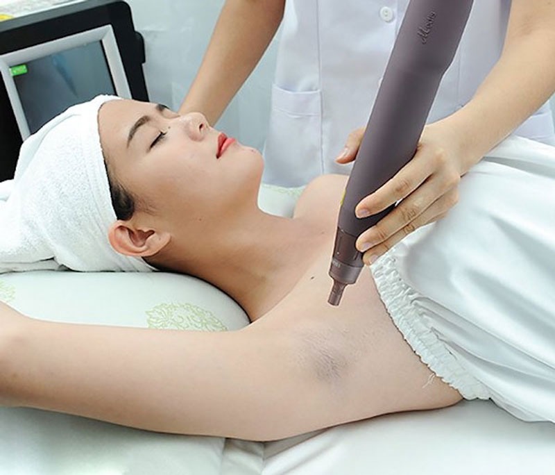 Spa trị thâm nách