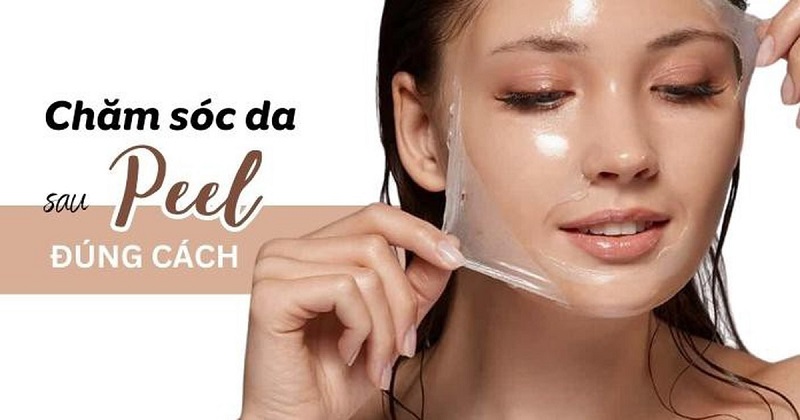 Cần chăm sóc da sau peel
