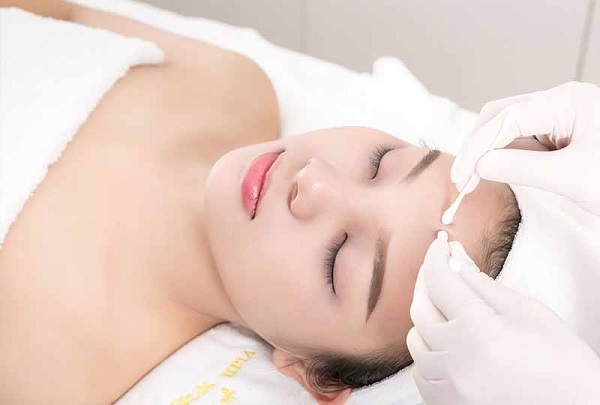 Da sau nặn mụn cần được chăm sóc
