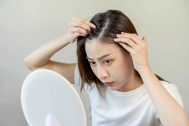 Tiêu chí chọn dầu gội cho da dầu dầu