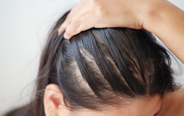 Dùng sai dầu gội khiến da đầu nhanh bết