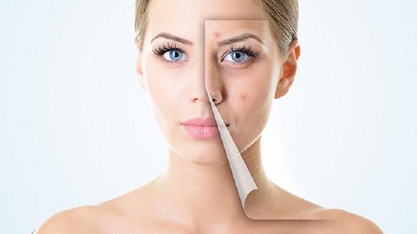 Thức khuya có nổi mụn không?
