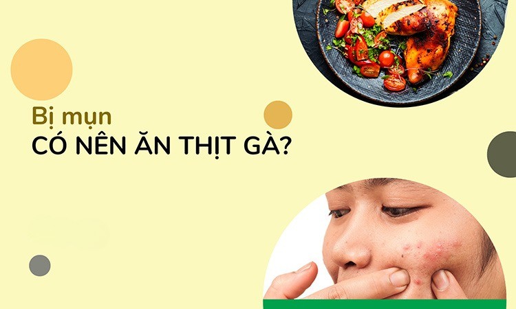 Bị mụn có nên ăn thịt gà không