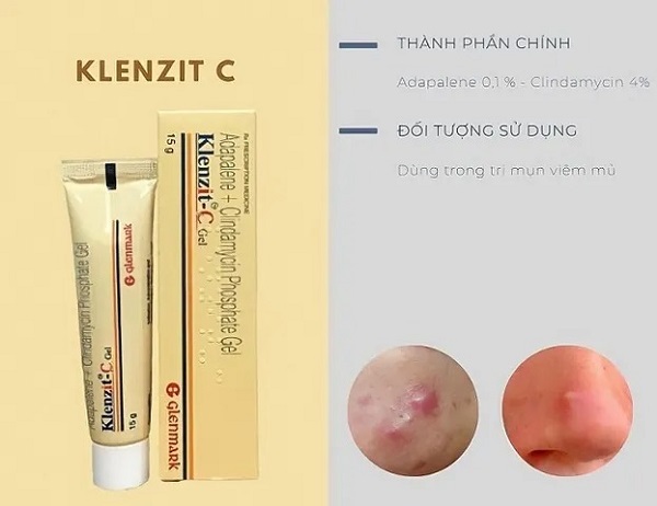 Klenzit C có đẩy mụn không