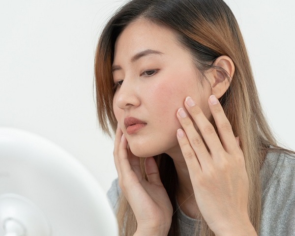 Mụn kích ứng có tự hết không