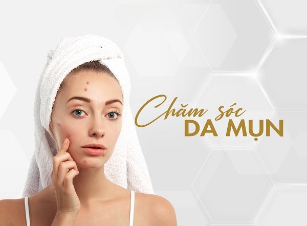 Chăm sóc mụn viêm đúng cách