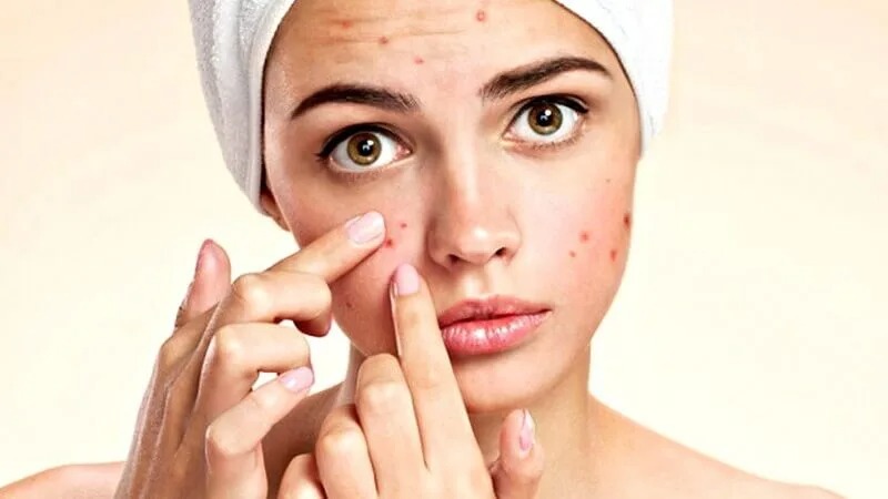 Uống DHC kẽm có bị nổi mụn không