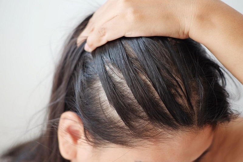 Cách gội đầu lâu bết tóc