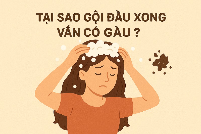 Tai sao gội đầu xong vẫn có gàu