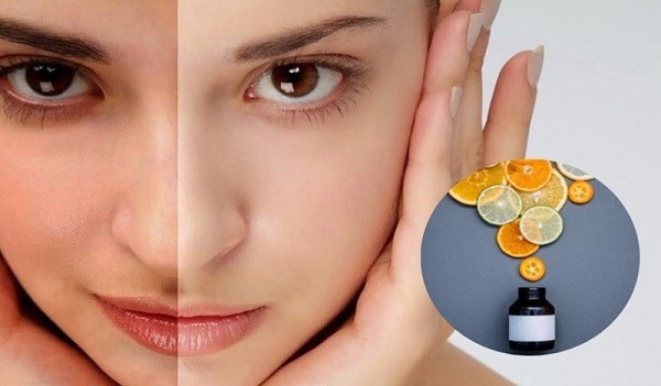 Uống vitamin C DHC có bị nổi mụn không