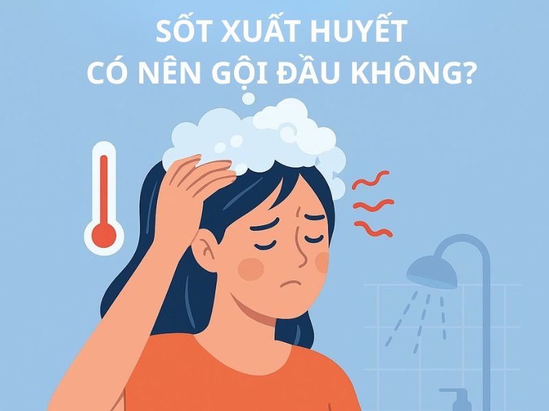 Sốt xuất huyết có nên gội đầu không?