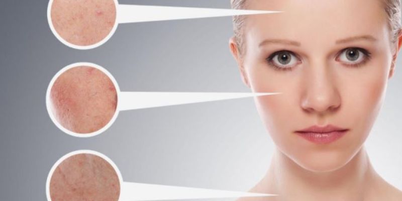 Da mặt bị hư tổn