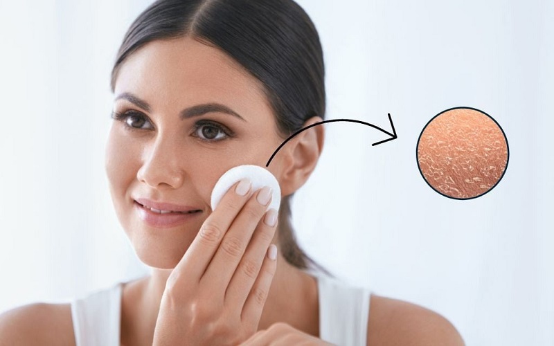 Da khô cần chọn loại tẩy trang phù hợp