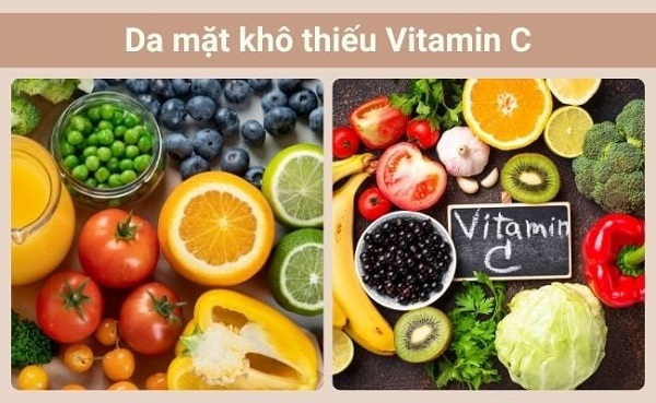 Da khô do thiếu vitamin C