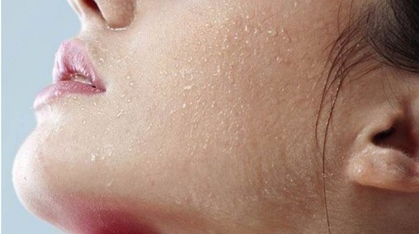 Chăm sóc da khô đúng cách