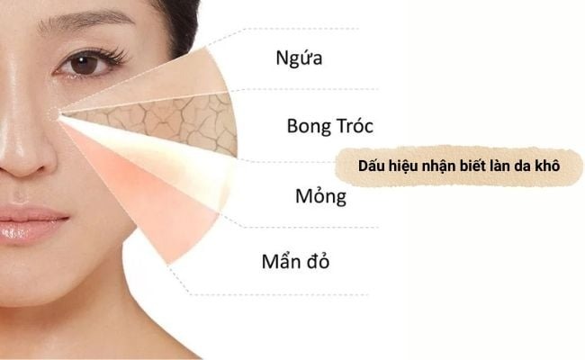 Dấu hiệu nhận biết da khô