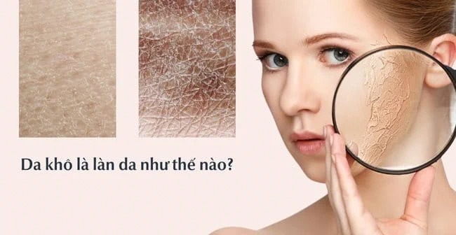 Có nhiều nguyên nhân khiến làn da trở nên khô hơn