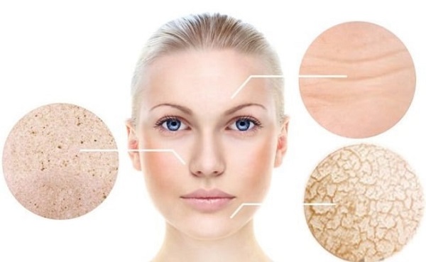 Đặc điểm làn da khô