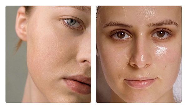 Da dầu và da khô