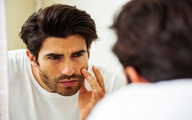 Xác định đúng loại da là bước quan trọng trước khi áp dụng các bước skincare cho nam