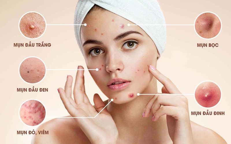 Các vấn đề về da ở tuổi dậy thì