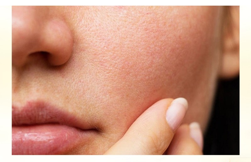 Da được phục hồi