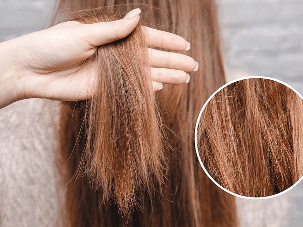 Tình trạng tóc cần phục hồi