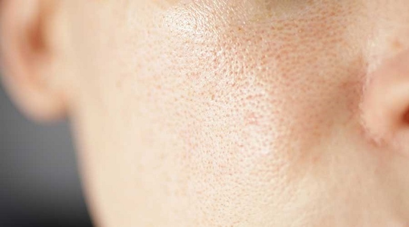 Cần skincare đúng cách