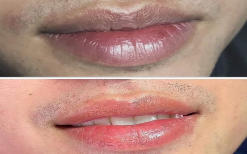 Thoa son dưỡng 2–3 lần/ngày để đạt hiệu quả tốt nhất