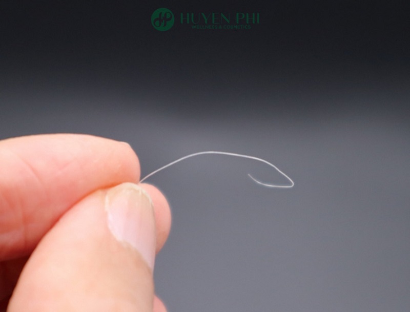 Bé 5 tuổi có 1 sợi tóc bạc có phải dấu hiệu bất thường?