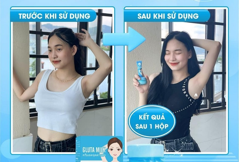 Kem trị thâm nách Gluta Milk được nhiều người quan tâm