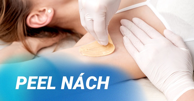 Peel da trị thâm có giá dao động mỗi buổi khoảng 500.000 – 1.500.000 đồng