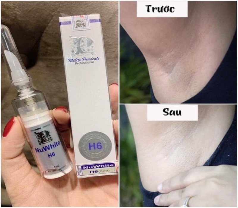 Trị thâm Nuwhite luôn là lựa chọn hàng đầu