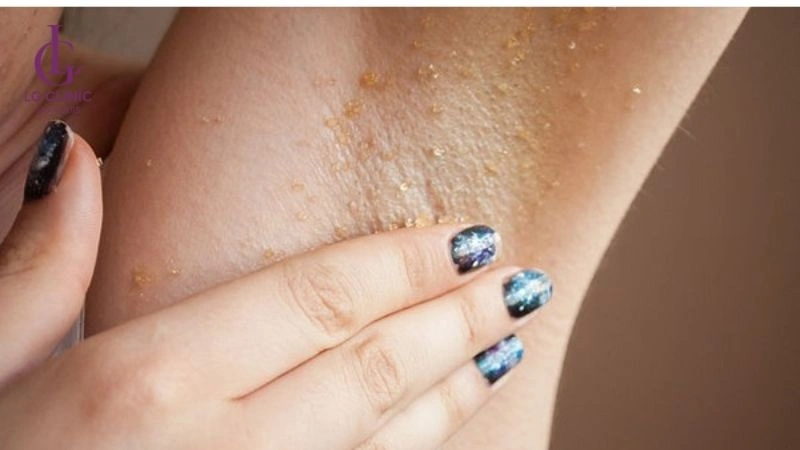 Tẩy tế bào chết vùng nách định kỳ