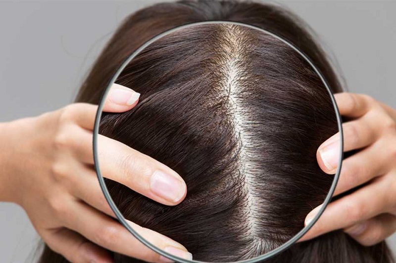 Giữ da đầu luôn sạch sẽ, khô thoáng