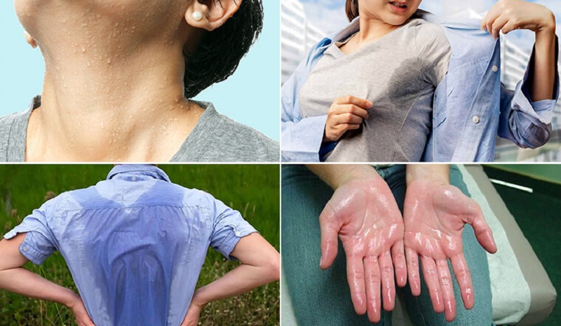 Ra mồ hôi nhiều có tốt không trong điều kiện bình thường?